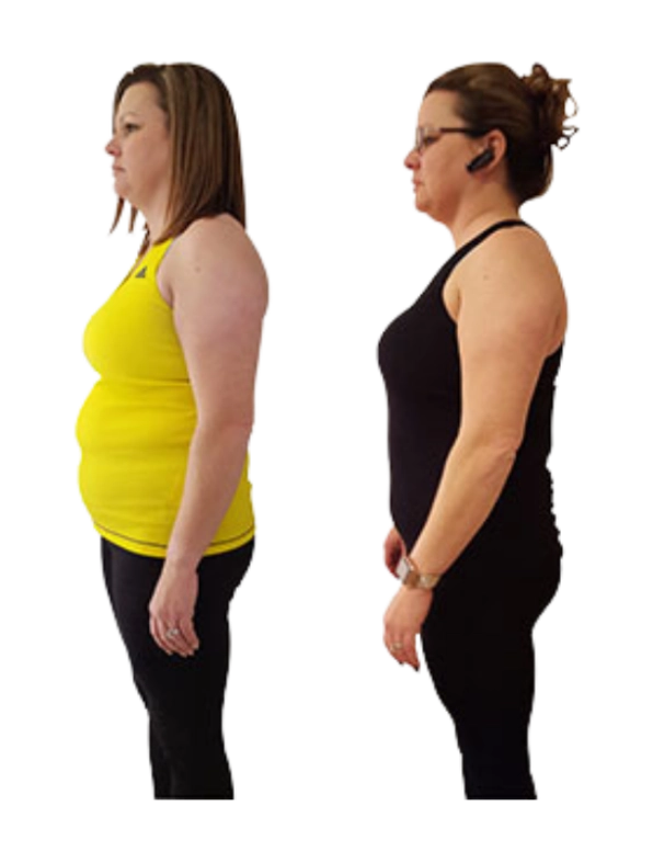 Woman_before_after_photo